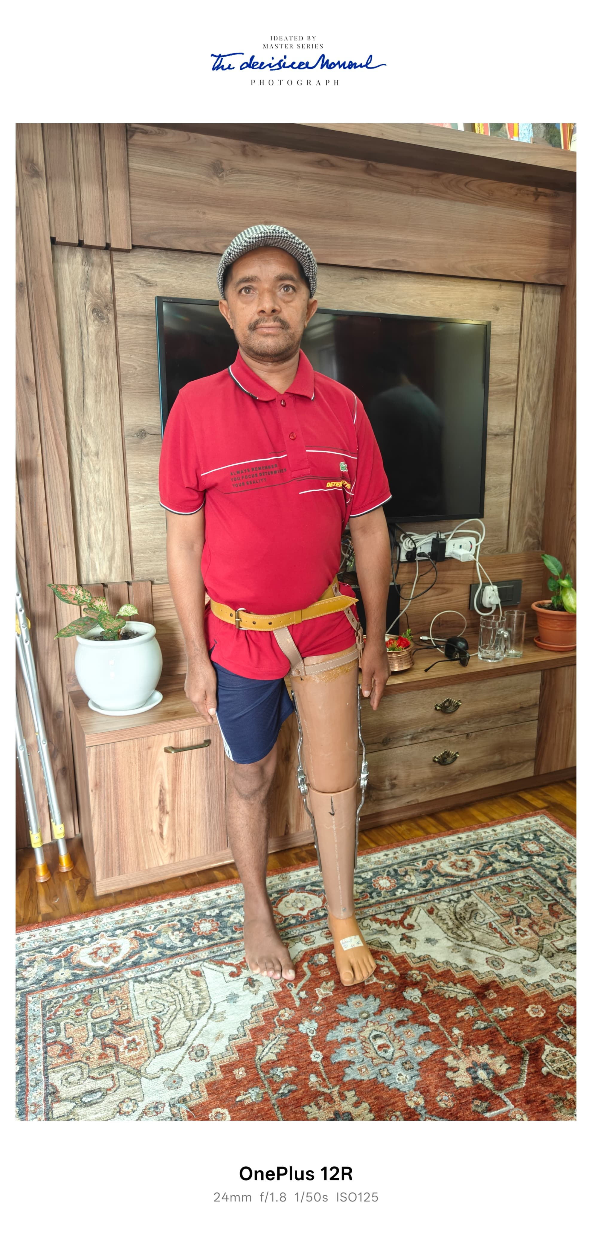 Artificial leg handover to Mr Prakash Poudel
