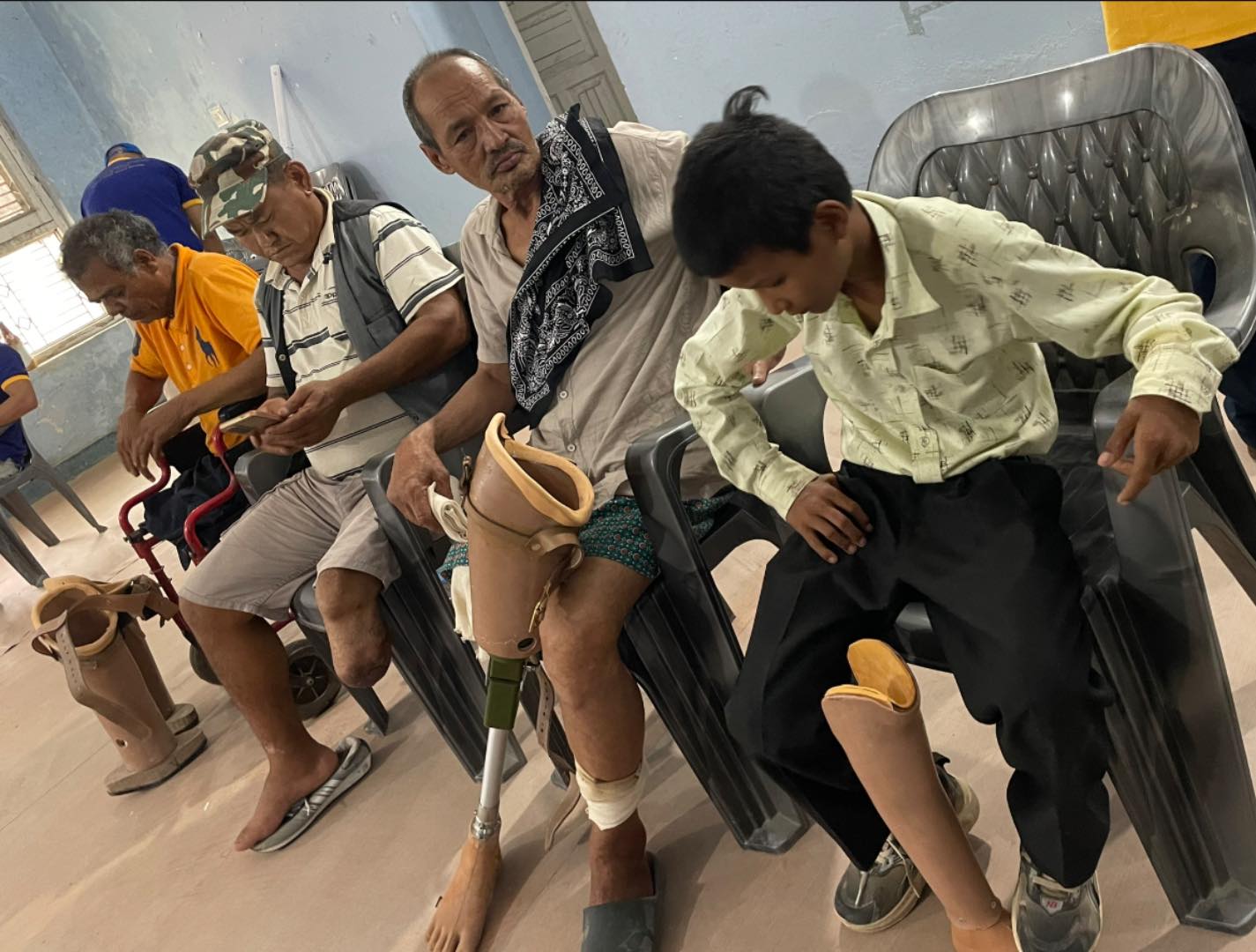 Financial Support for artificial legs (limbs)